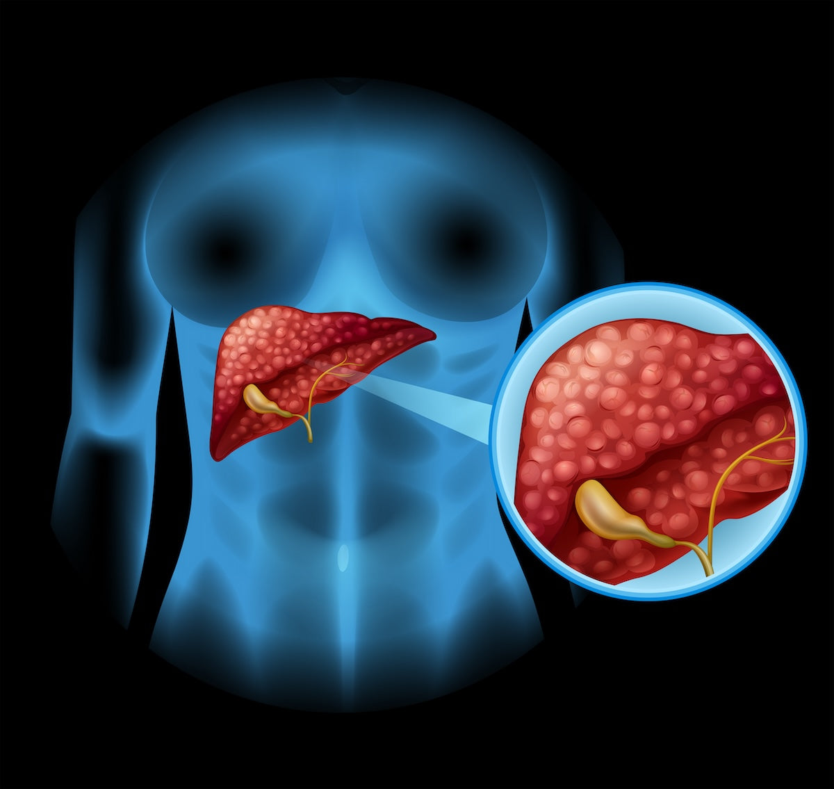 Die Funktion der Leber und der Gallenblase: Cholesterinproduktion, -regulation und -ausscheidung